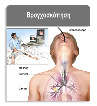 broxo1